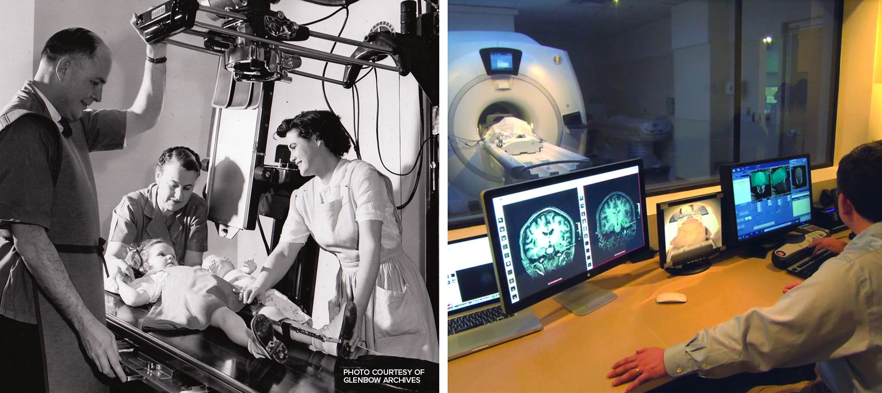 Diagnostic Imaging from the mid 1900s vs the 2000